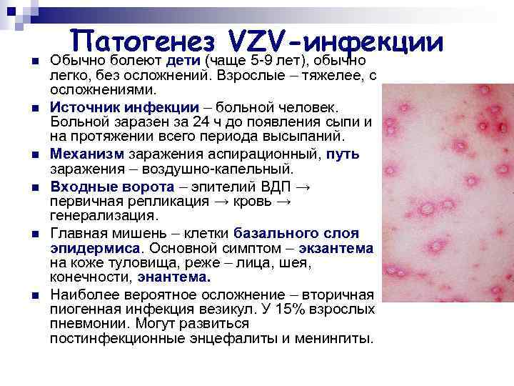 n n n Патогенез VZV-инфекции Обычно болеют дети (чаще 5 -9 лет), обычно легко,