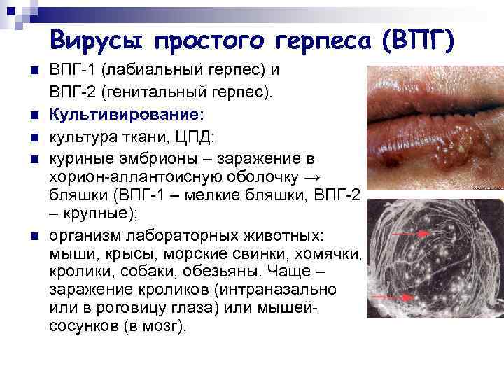 Вирусы простого герпеса (ВПГ) n n n ВПГ-1 (лабиальный герпес) и ВПГ-2 (генитальный герпес).