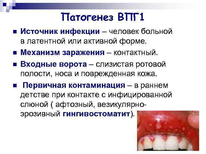 Патогенез ВПГ 1 n n Источник инфекции – человек больной в латентной или активной