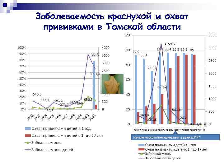 Заболеваемость краснухой и охват прививками в Томской области 