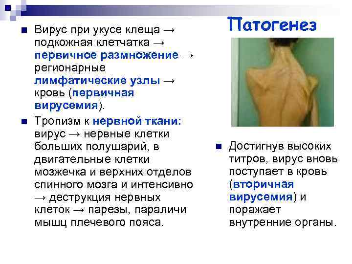 n n Вирус при укусе клеща → подкожная клетчатка → первичное размножение → регионарные