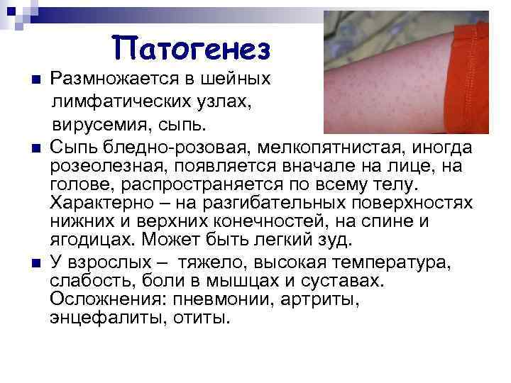 Патогенез n n n Размножается в шейных лимфатических узлах, вирусемия, сыпь. Сыпь бледно-розовая, мелкопятнистая,
