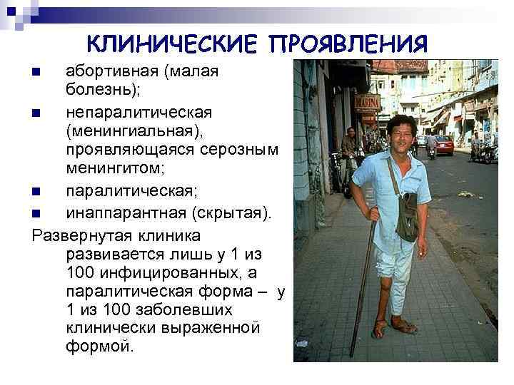 КЛИНИЧЕСКИЕ ПРОЯВЛЕНИЯ абортивная (малая болезнь); n непаралитическая (менингиальная), проявляющаяся серозным менингитом; n паралитическая; n