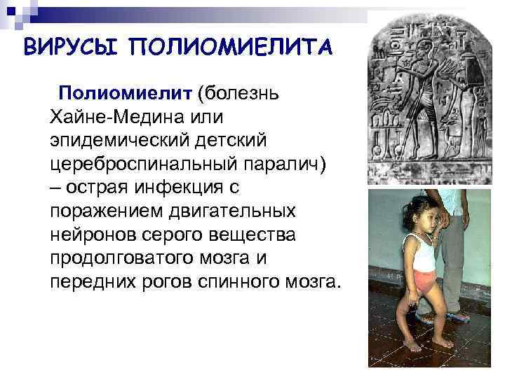 ВИРУСЫ ПОЛИОМИЕЛИТА Полиомиелит (болезнь Хайне-Медина или эпидемический детский цереброспинальный паралич) – острая инфекция с