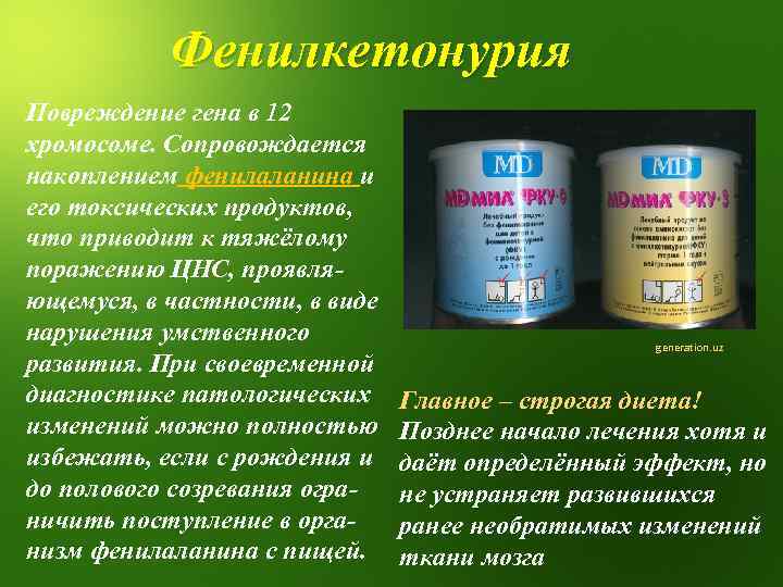 Фенилкетонурия Повреждение гена в 12 хромосоме. Сопровождается накоплением фенилаланина и его токсических продуктов, что