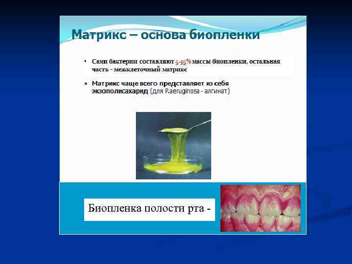 Биопленка полости рта - 