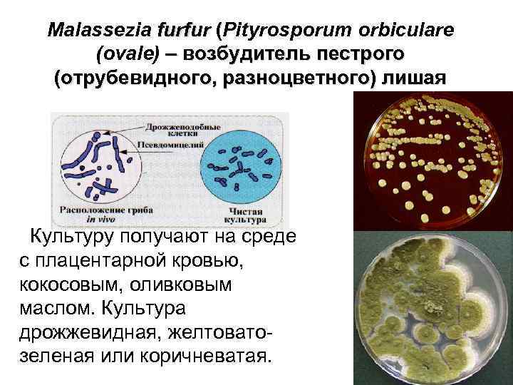 Malassezia furfur (Pityrosporum orbiculare (ovale) – возбудитель пестрого (отрубевидного, разноцветного) лишая Культуру получают на