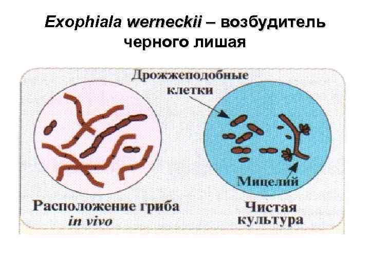 Exophiala werneckii – возбудитель черного лишая 