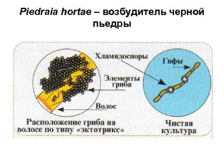 Piedraia hortae – возбудитель черной пьедры 