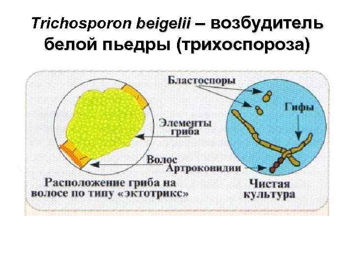 Trichosporon beigelii – возбудитель белой пьедры (трихоспороза) 