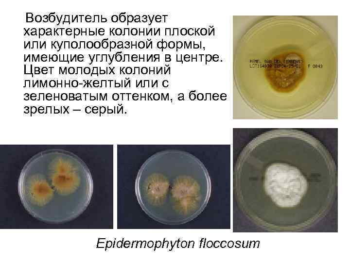  Возбудитель образует характерные колонии плоской или куполообразной формы, имеющие углубления в центре. Цвет
