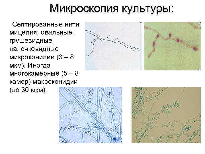 Микроскопия культуры: Септированные нити мицелия; овальные, грушевидные, палочковидные микроконидии (3 – 8 мкм). Иногда