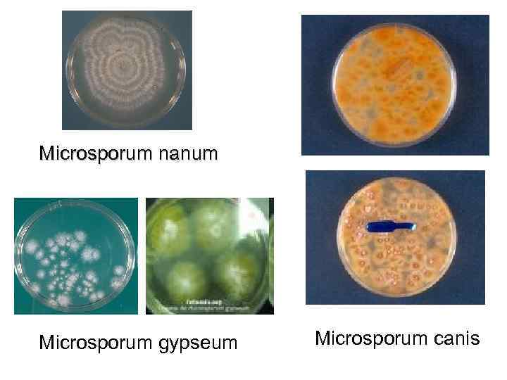 Microsporum nanum Microsporum gypseum Microsporum canis 