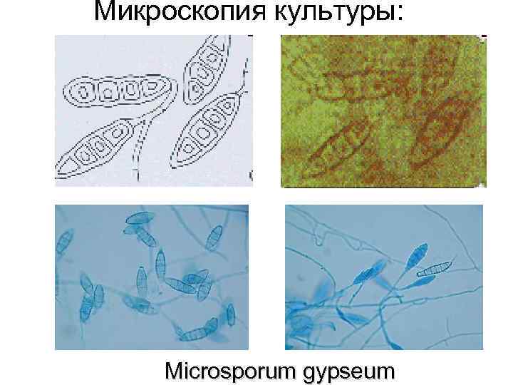 Микроскопия культуры: Microsporum gypseum 