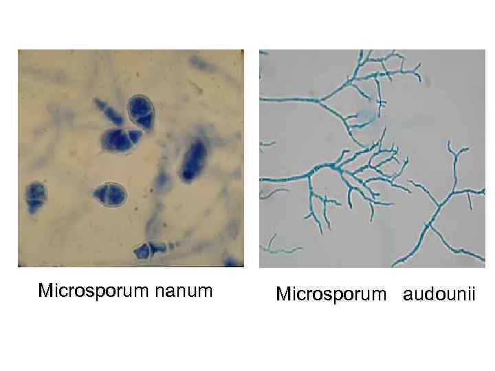 Microsporum nanum Microsporum audounii 