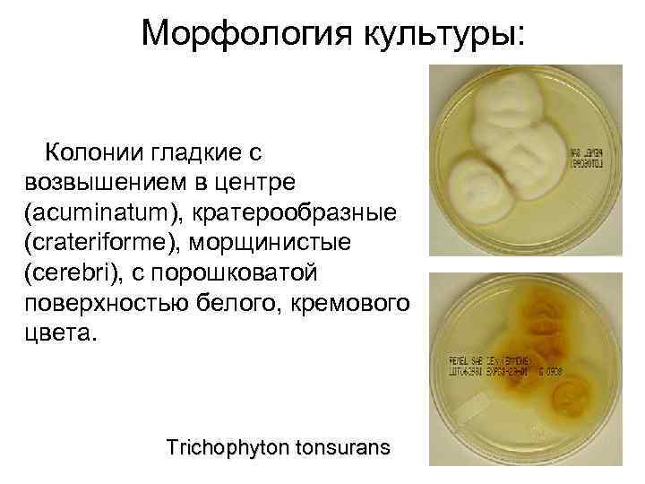 Морфология культуры: Колонии гладкие с возвышением в центре (acuminatum), кратерообразные (crateriforme), морщинистые (cerebri), с