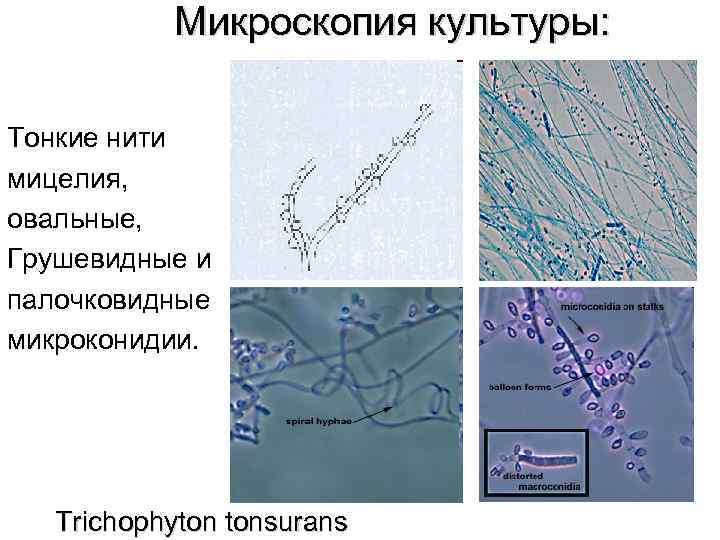 Микроскопия культуры: Тонкие нити мицелия, овальные, Грушевидные и палочковидные микроконидии. Trichophyton tonsurans 