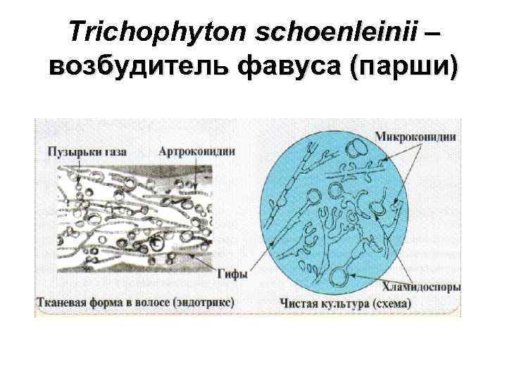 Trichophyton schoenleinii – возбудитель фавуса (парши) 