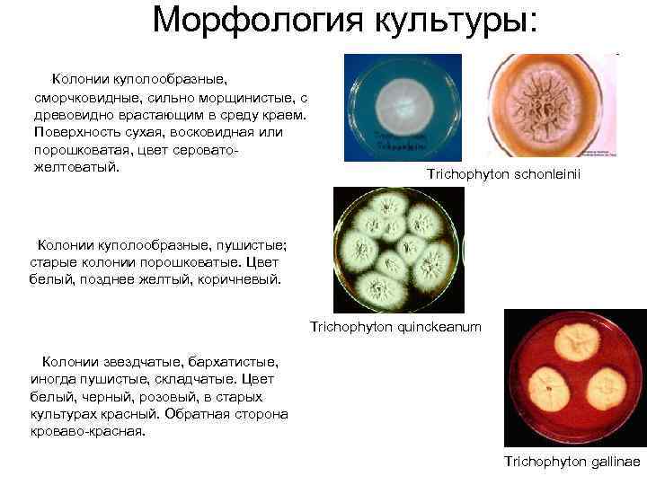 Морфология культуры: Колонии куполообразные, сморчковидные, сильно морщинистые, с древовидно врастающим в среду краем. Поверхность