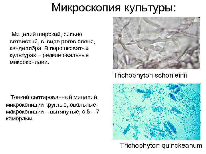 Микроскопия культуры: Мицелий широкий, сильно ветвистый, в виде рогов оленя, канделябра. В порошковатых культурах