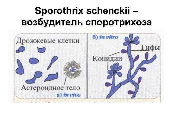 Sporothrix schenckii – возбудитель споротрихоза 