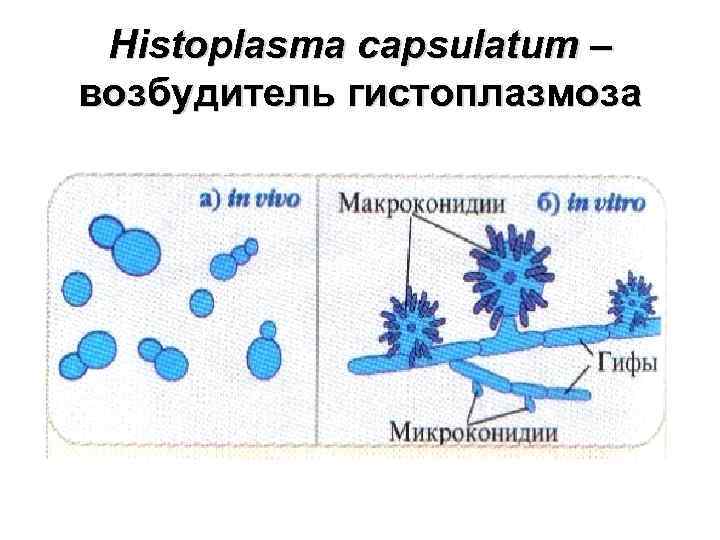 Histoplasma capsulatum – возбудитель гистоплазмоза 