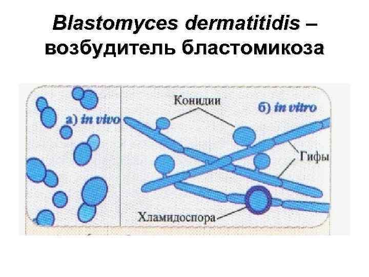 Blastomyces dermatitidis – возбудитель бластомикоза 