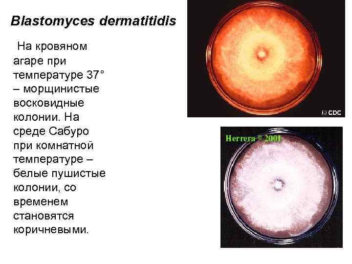 Blastomyces dermatitidis На кровяном агаре при температуре 37° – морщинистые восковидные колонии. На среде