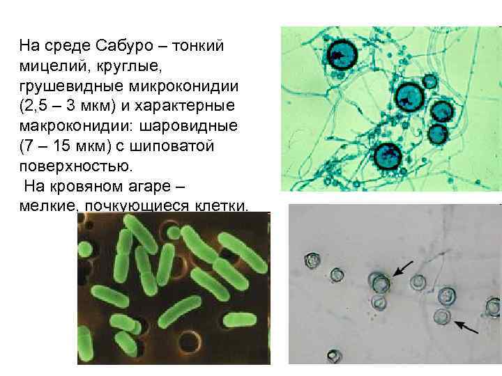 На среде Сабуро – тонкий мицелий, круглые, грушевидные микроконидии (2, 5 – 3 мкм)