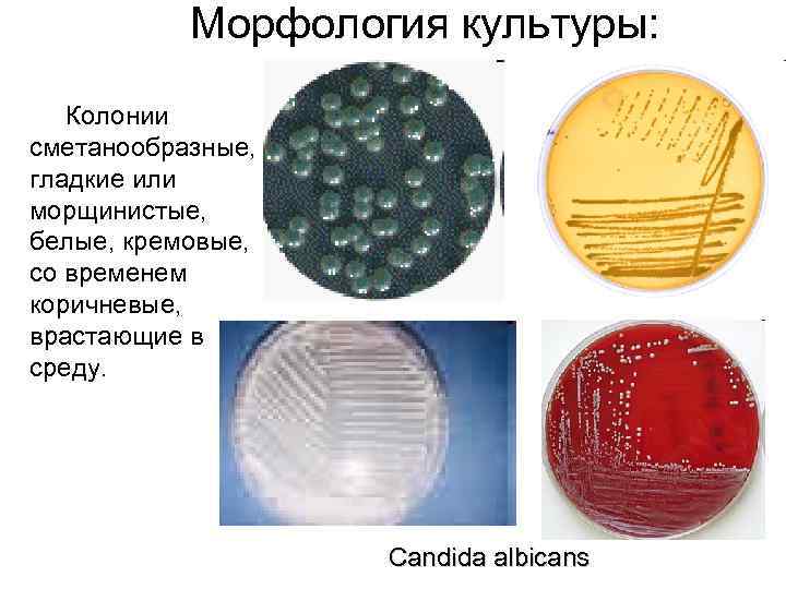 Морфология культуры: Колонии сметанообразные, гладкие или морщинистые, белые, кремовые, со временем коричневые, врастающие в