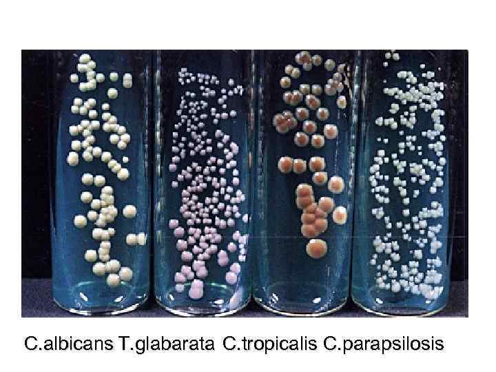  C. albicans T. glabarata C. tropicalis C. parapsilosis 