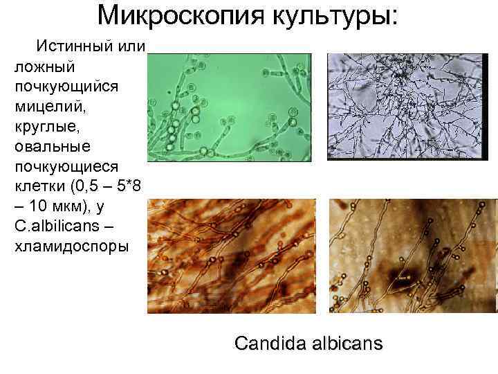 Микроскопия культуры: Истинный или ложный почкующийся мицелий, круглые, овальные почкующиеся клетки (0, 5 –