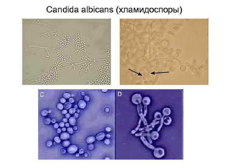  Candida albicans (хламидоспоры) 