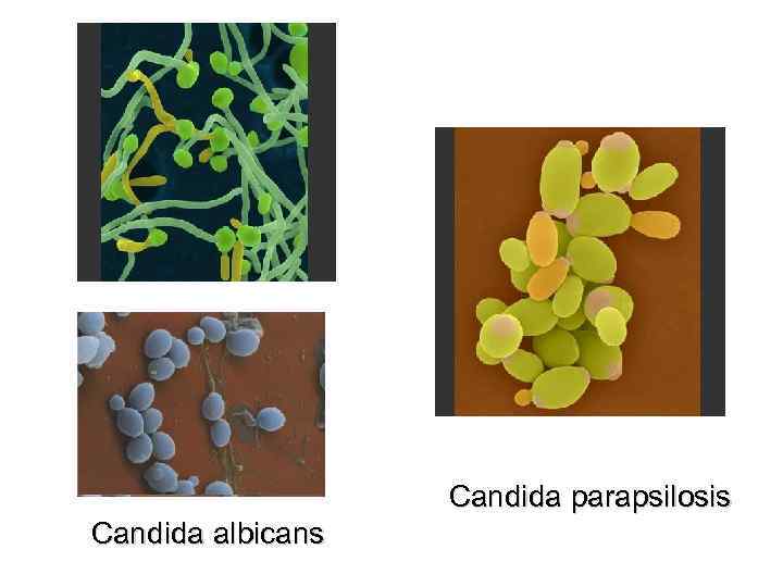 Candida parapsilosis Candida albicans 