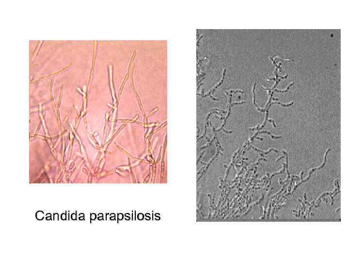 Candida parapsilosis 