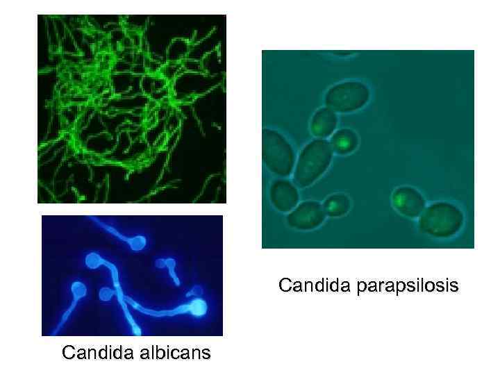 Candida parapsilosis Candida albicans 