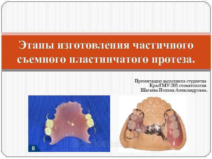 Этапы изготовления частичного съемного пластинчатого протеза. Презентацию выполнила студентка Крас. ГМУ 205 стоматология Шагаева