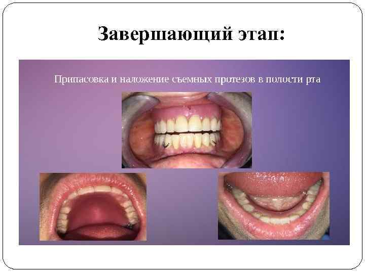 Завершающий этап: 