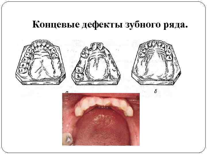 Образец пластинчатого коралла субнаутика