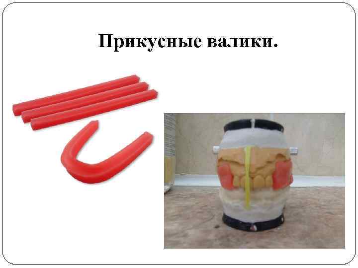 Прикусные валики. 