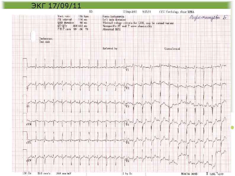 ЭКГ 17/09/11 
