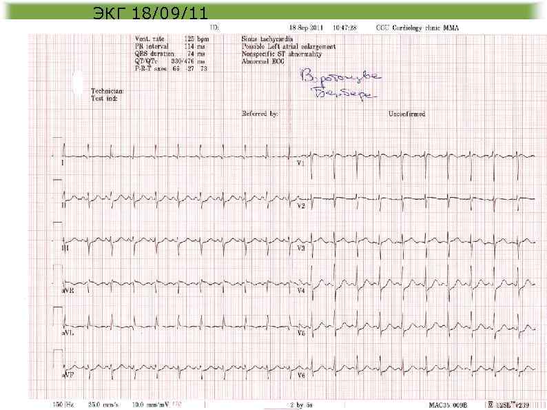 ЭКГ 18/09/11 