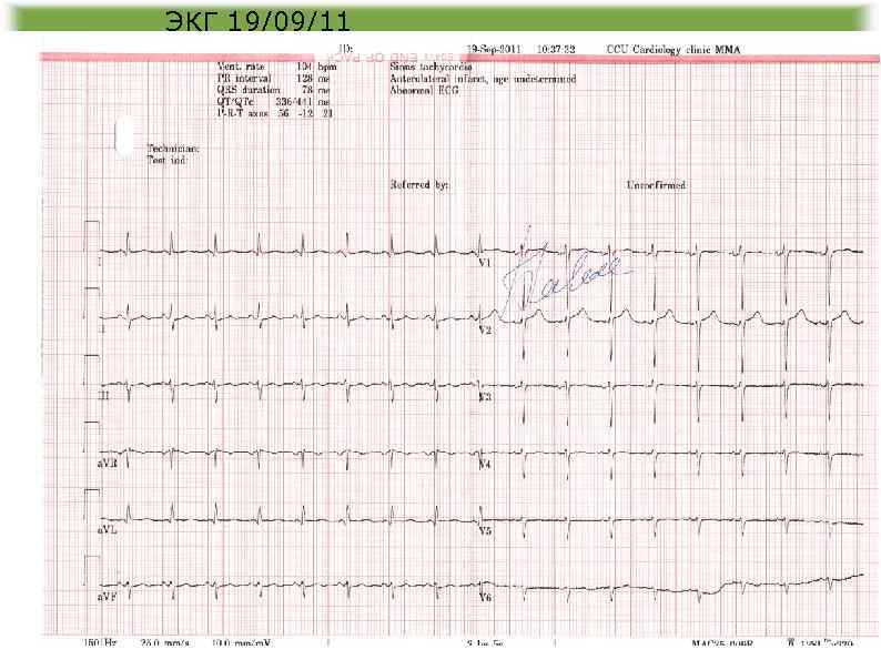 ЭКГ 19/09/11 