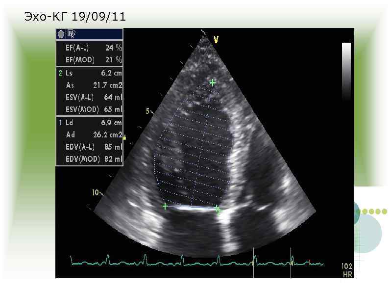 Эхо Кг Сердца Цена К31