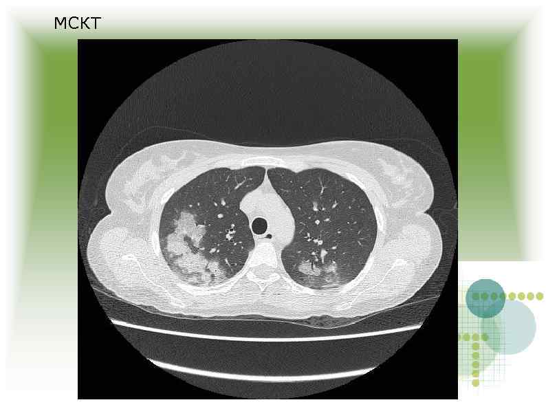 МСКТ 