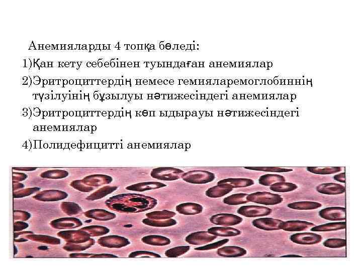 Анемияларды 4 топқа бөледі: 1)Қан кету себебінен туындаған анемиялар 2)Эритроциттердің немесе гемияларемоглобиннің түзілуінің бұзылуы