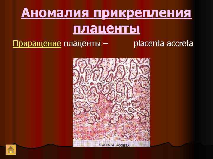 Аномалия прикрепления плаценты Приращение плаценты – placenta accreta 