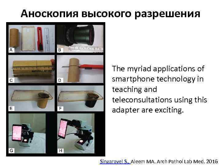 Аноскопия высокого разрешения The myriad applications of smartphone technology in teaching and teleconsultations using