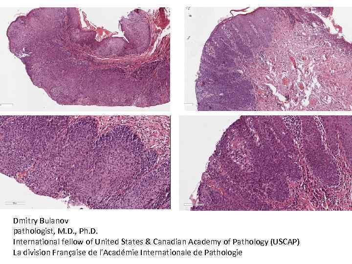 Dmitry Bulanov pathologist, M. D. , Ph. D. International fellow of United States &