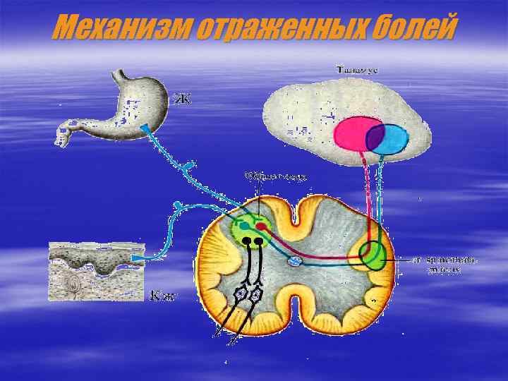 Механизм отраженных болей 